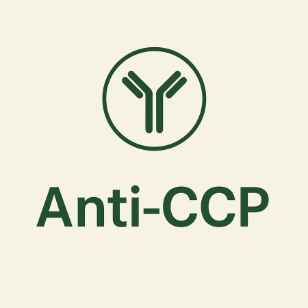 تحليل الروماتيزم